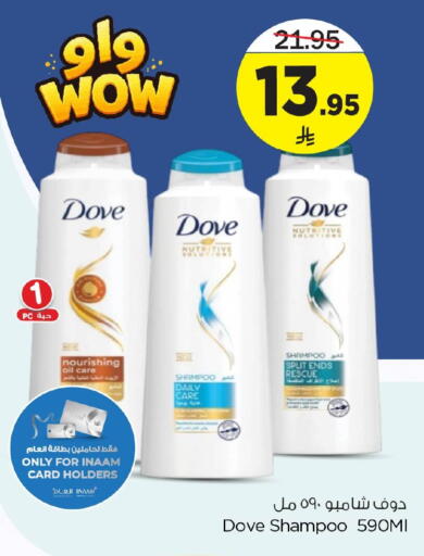 available at Nesto in KSA, Saudi Arabia, Saudi - Dammam