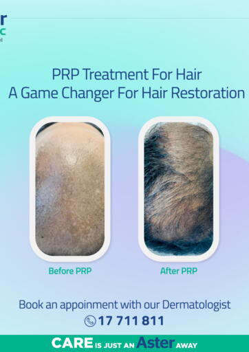 Bahrain Aster Clinic offers in D4D Online. PRP Treatment For Hair A Game Changer For Hair Restoration. . Till 29th April
