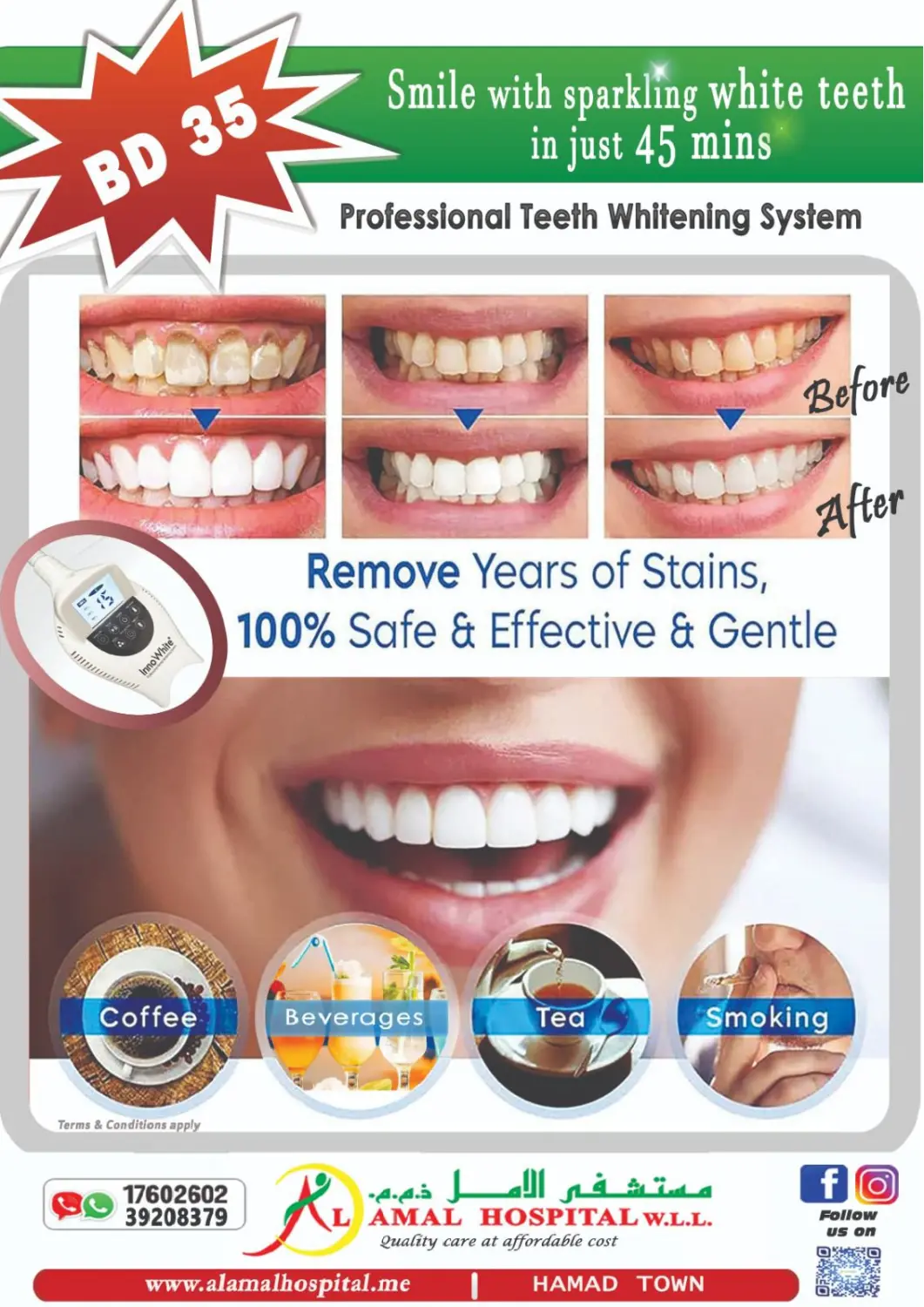 عروض مستشفى الأمل البحرين في دي٤دي أونلاين. نظام تبييض أسنان احترافي. . حتى ٣٠ أغسطس