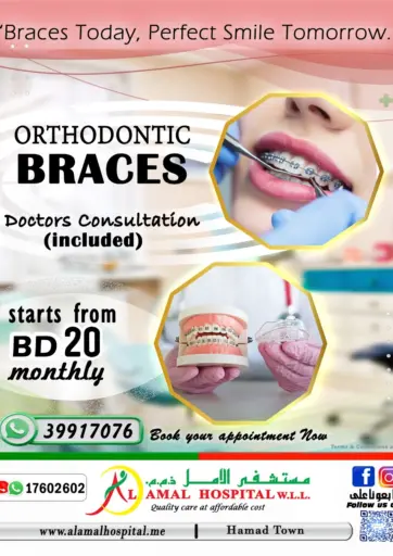 Orthodontic Braces